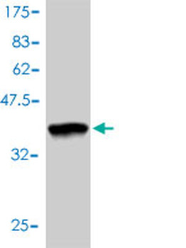 RAD51C monoclonal antibody (M01), clone 3F3-5C6