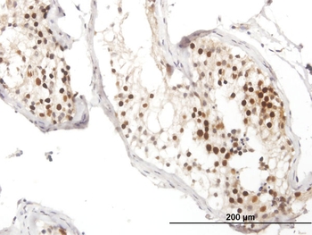 RAD51 MaxPab mouse polyclonal antibody (B01)