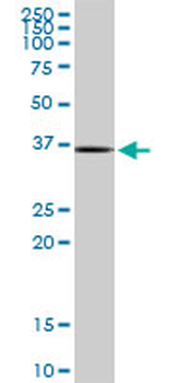 RAD51 MaxPab mouse polyclonal antibody (B01)