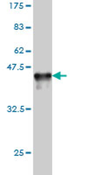 RAD23A monoclonal antibody (M01), clone 3C12