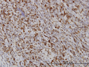 RAB27A monoclonal antibody (M02), clone 1G7