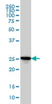 RAB27A monoclonal antibody (M02), clone 1G7