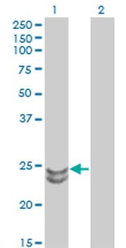 RAB27A monoclonal antibody (M02), clone 1G7