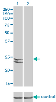RAB27A monoclonal antibody (M02), clone 1G7