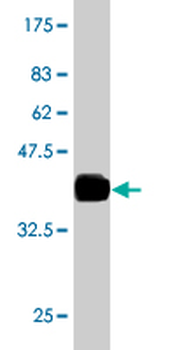 RAB27A monoclonal antibody (M02), clone 1G7