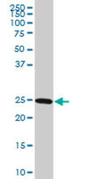 RAB27A monoclonal antibody (M01), clone 4C1