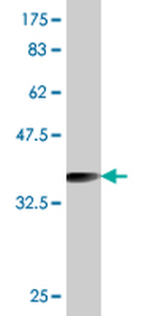 RAB27A monoclonal antibody (M01), clone 4C1