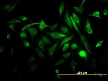 RAB3B monoclonal antibody (M01), clone 3F12