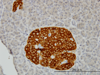 RAB3B monoclonal antibody (M01), clone 3F12