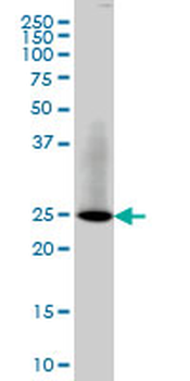 RAB3B monoclonal antibody (M01), clone 3F12