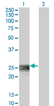 RAB3B monoclonal antibody (M01), clone 3F12