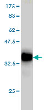 RAB3B monoclonal antibody (M01), clone 3F12