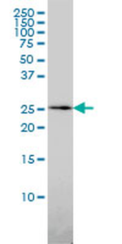 QDPR monoclonal antibody (M02), clone M1