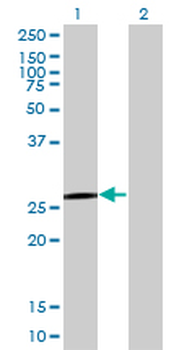 QDPR monoclonal antibody (M02), clone M1