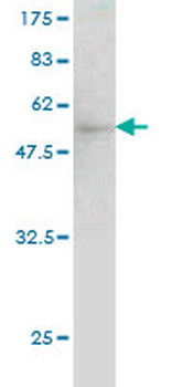 QDPR monoclonal antibody (M02), clone M1
