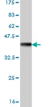 ALDH18A1 monoclonal antibody (M01), clone 2B5