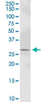 PYCR1 purified MaxPab mouse polyclonal antibody (B01P)