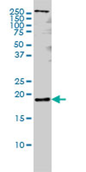PTN monoclonal antibody (M01), clone 5C3