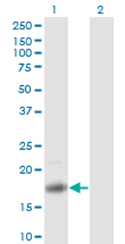 PTN monoclonal antibody (M01), clone 5C3