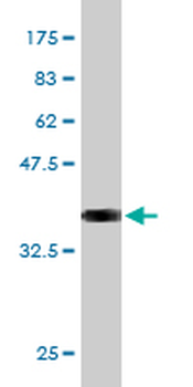 PTN monoclonal antibody (M01), clone 5C3