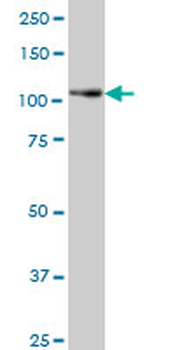 PTK7 monoclonal antibody (M06), clone 4F5