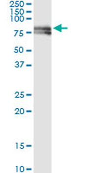 PTK2 monoclonal antibody (M01), clone 2C3