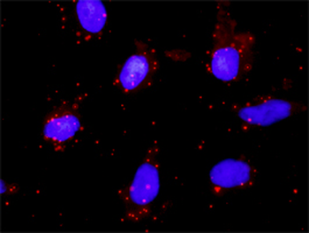 PTK2 monoclonal antibody (M01), clone 2C3