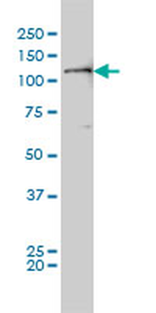 PTK2 monoclonal antibody (M01), clone 2C3