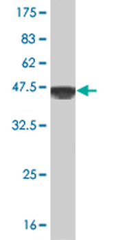 PTK2 monoclonal antibody (M01), clone 2C3