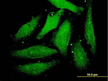 PTHLH monoclonal antibody (M01), clone 3H1-5G8