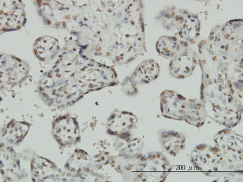 PTHLH monoclonal antibody (M01), clone 3H1-5G8