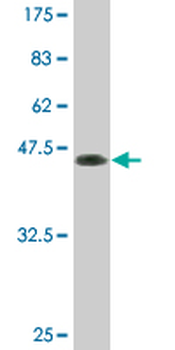 PTHLH monoclonal antibody (M01), clone 3H1-5G8