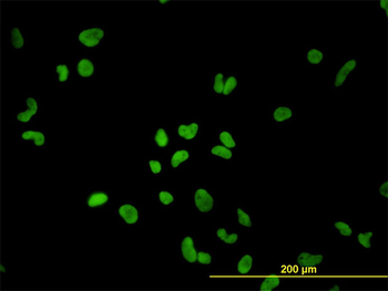 PTBP1 monoclonal antibody (M01), clone 3H8