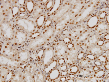 PTBP1 monoclonal antibody (M01), clone 3H8