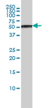 PTBP1 monoclonal antibody (M01), clone 3H8