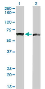 PTBP1 monoclonal antibody (M01), clone 3H8