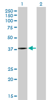 PSMB5 purified MaxPab rabbit polyclonal antibody (D01P)