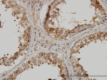 PSMB4 monoclonal antibody (M01), clone 6G7-E8