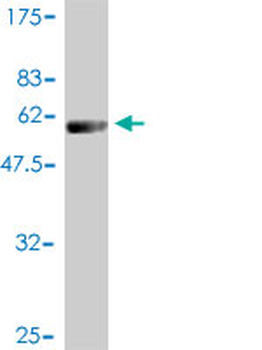 PSMB4 monoclonal antibody (M01), clone 6G7-E8
