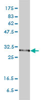 PSMA1 monoclonal antibody (M01), clone 1D9-1C7