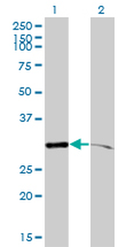 PSMA1 monoclonal antibody (M01), clone 1D9-1C7