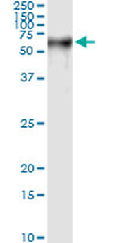 PSAP monoclonal antibody (M01), clone 1D1-C12