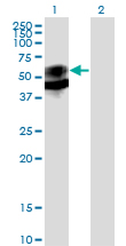 PSAP monoclonal antibody (M01), clone 1D1-C12
