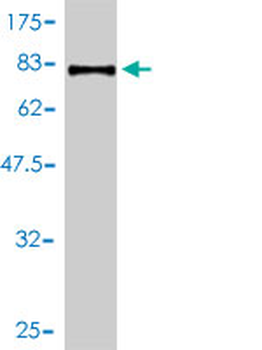 PSAP monoclonal antibody (M01), clone 1D1-C12