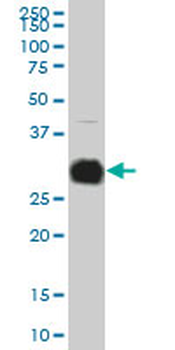 KLK10 monoclonal antibody (M01), clone 1G8