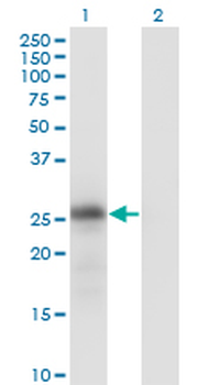 KLK6 monoclonal antibody (M01), clone 4A10