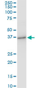 PRSS8 monoclonal antibody (M11A), clone 3C4