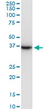 PRSS8 monoclonal antibody (M11A), clone 3C4