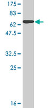 PRSS8 monoclonal antibody (M11A), clone 3C4