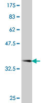 PRPS2 polyclonal antibody (A01)